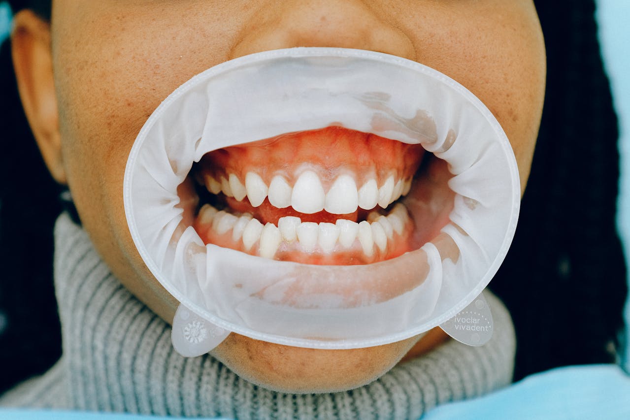 Dental Health